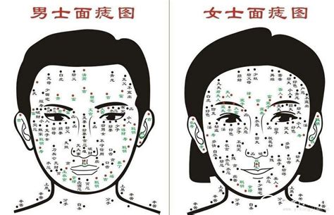 屁股 痣|屁股长痣图解与命运分析 痣在屁股有何寓意？